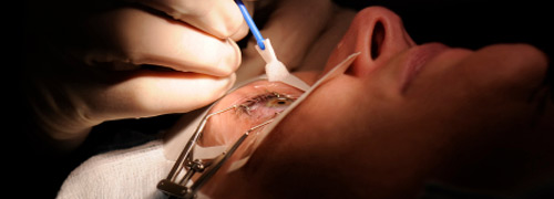 Post image for Commotion around eyelaser surgery
