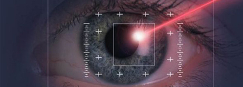 Post image for Voordelig ooglaseren bij eYellow